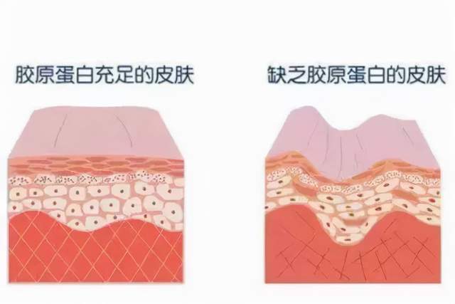 补充|比啥猪蹄桃胶都管用！一袋胶原蛋白饮，喝出彭彭弹弹少女肌