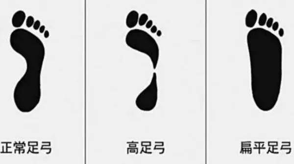脚背|你的凉鞋该换了，今夏就穿这4双