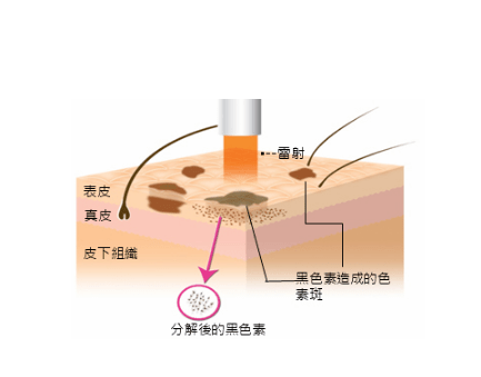 护肤品|敬修堂佰花方：看了同款雀斑妆，才知道淡斑是势在必行！