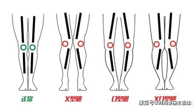 身材|立秋后别只穿裙子，土气！今年流行这样穿，轻松穿出高级感
