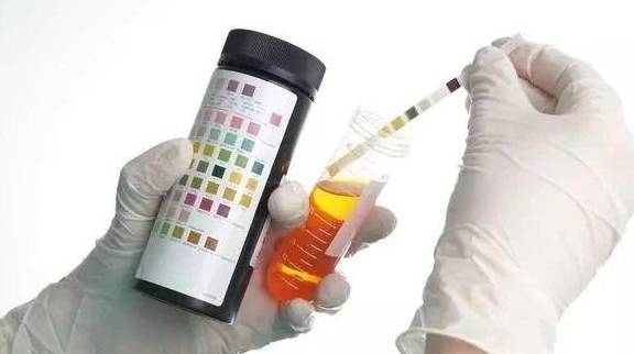 祸首|出现蛋白尿,3个因素要重视