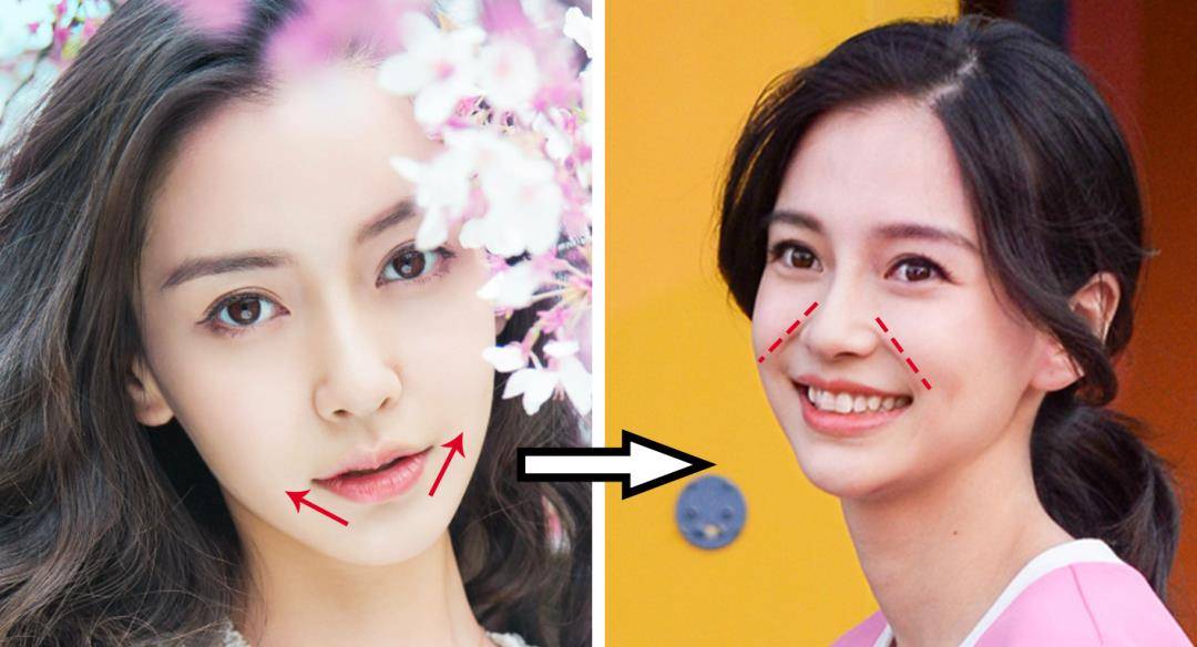 牙龈|有些人明明长得挺不错，但为什么笑起来不好看？