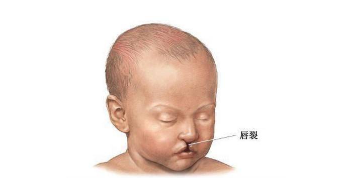 原创孕5个月查出胎儿畸形,医生:身上味不对!这4种味道孕妈不能沾