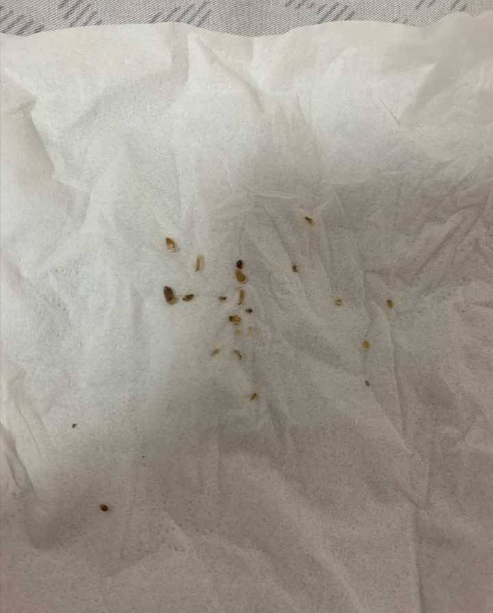 黑头|硬核国货登场众筹,吸一次就能见效果,男女通用,仅149一送一