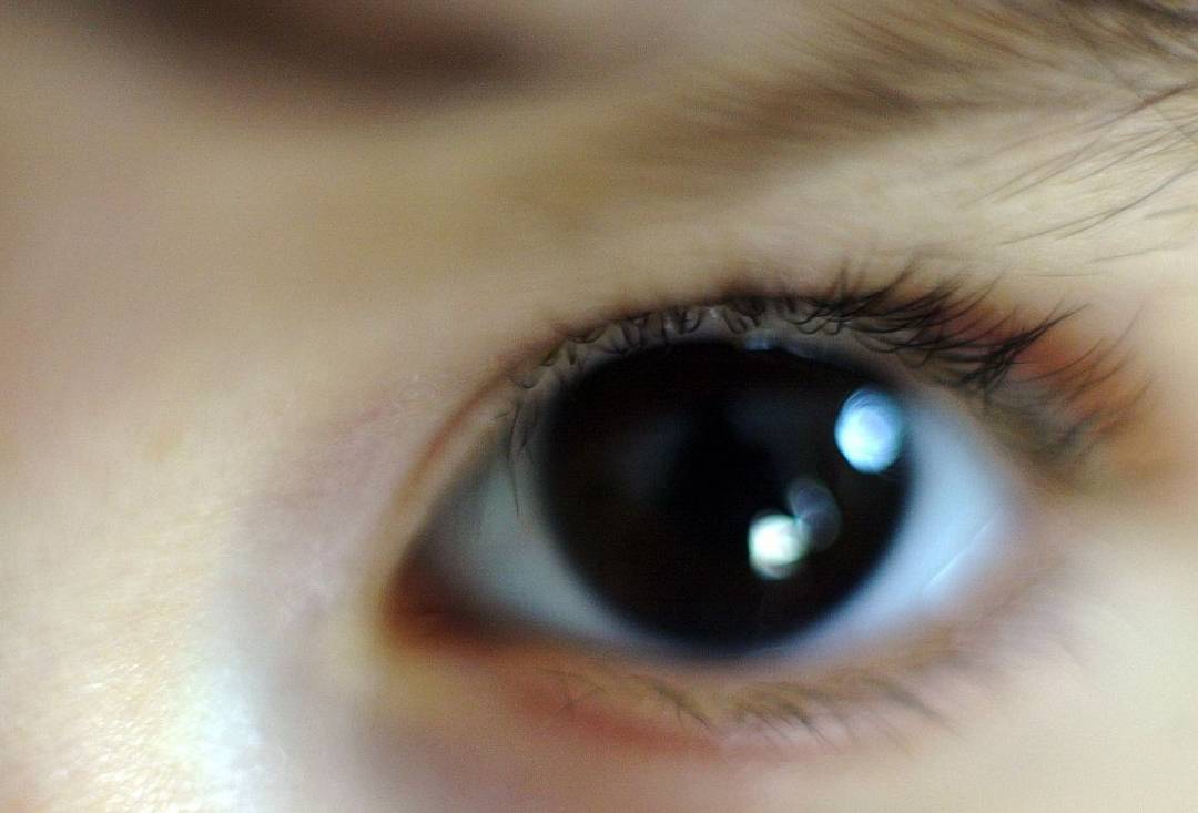 眼睛|血糖超标，“眼睛”先知道！若没有出现4异常，祝贺，血糖很稳定