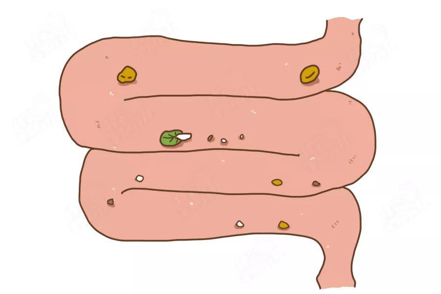 香蕉|吃香蕉不通便，越吃越堵！这些水果才是“便秘克星”！