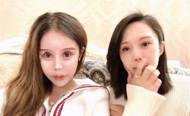 人间|13岁女孩为变漂亮,3年整容60次成小网红,自称是人间芭比