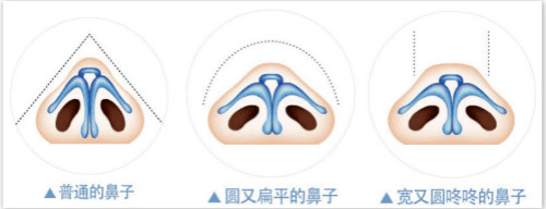 整形|权威！鼻部美学设计最全解析