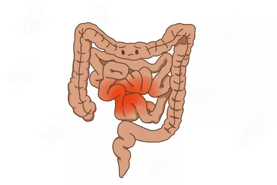 香蕉|吃香蕉不通便，越吃越堵！这些水果才是“便秘克星”！