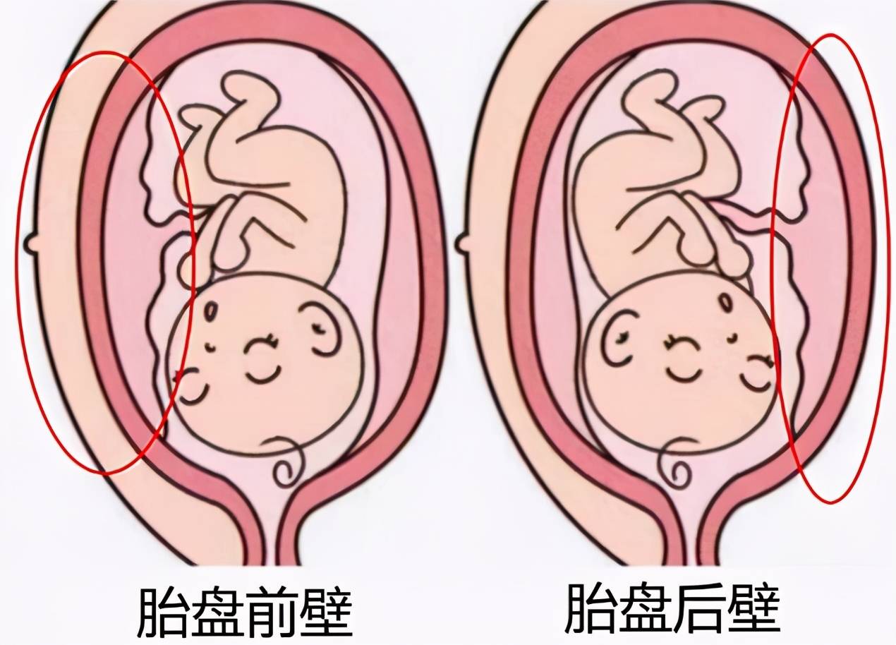 子宫胎盘图片