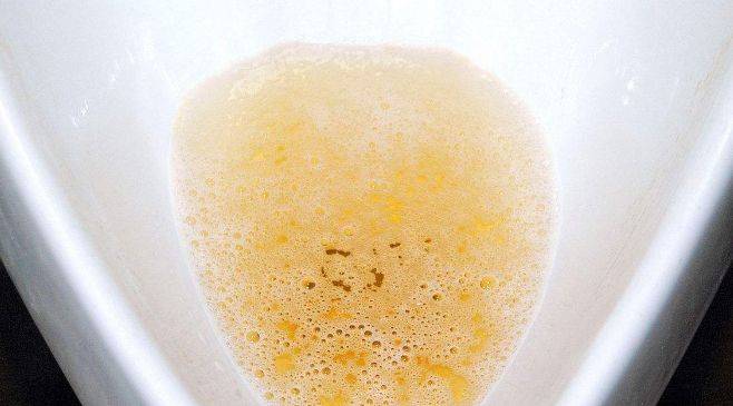 症状|身体出现3个症状,糖尿病可能正悄悄走向尿毒症,早发现早受益