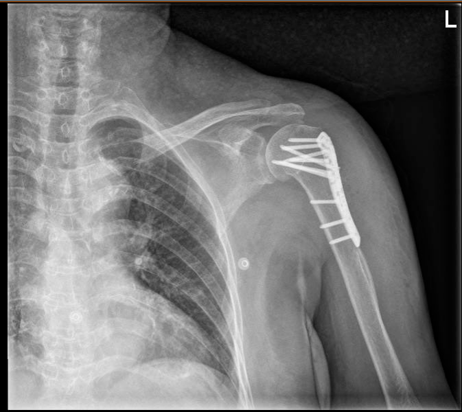 治疗|精准评估，多学科诊疗护佑老年患者健康