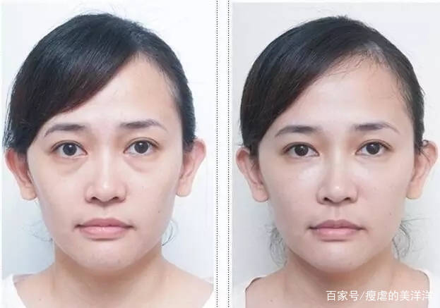 眼睛|有眼袋，20岁的小仙女也会被拖累成老阿姨！