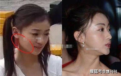 下巴|那些一刀切削骨的明星还好吗？后遗症一大堆，小方脸成最大赢家