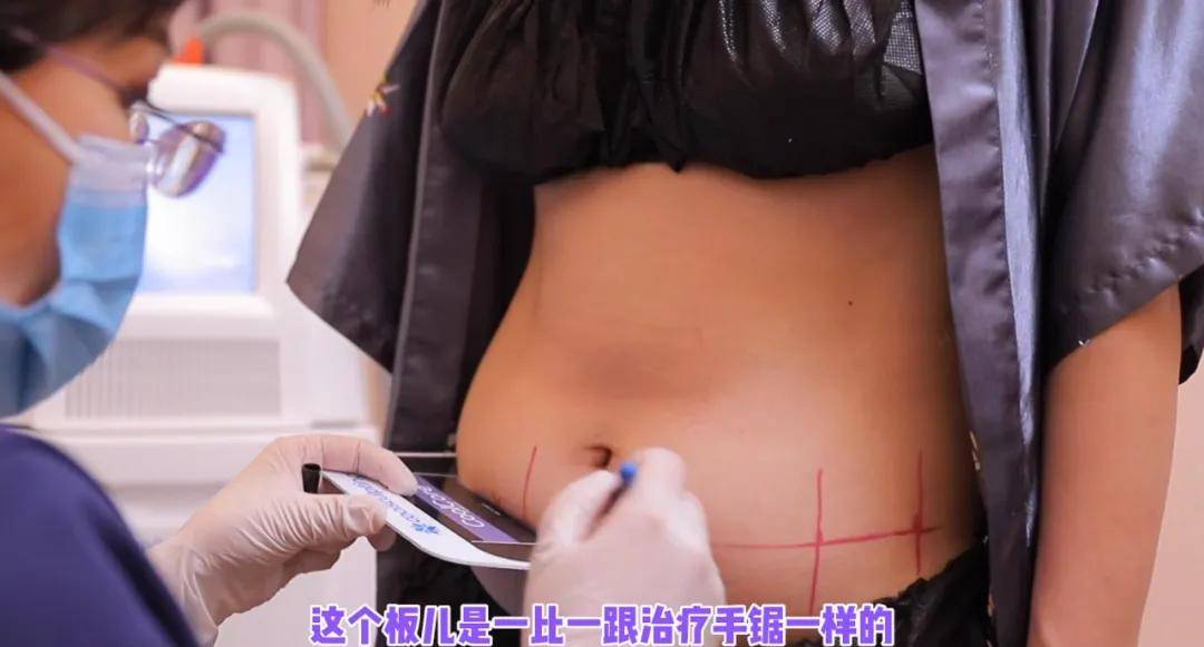效果|孔雪儿怎么肿成这样？这是填充失败了吗？！