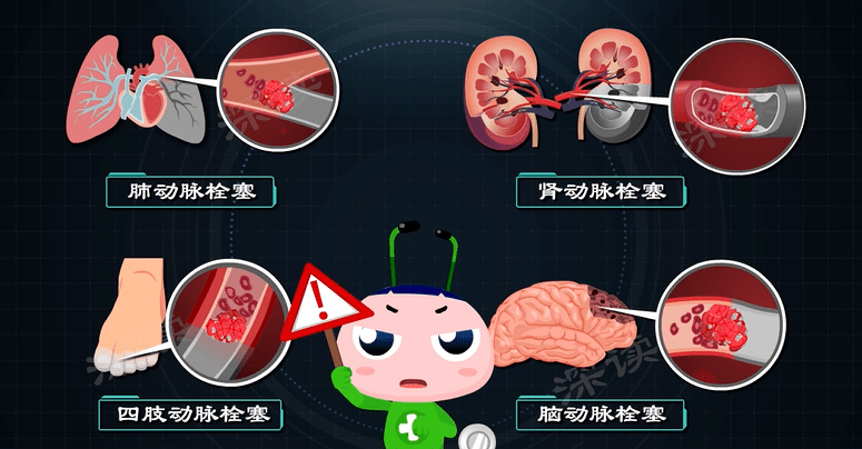 治疗|患者超1000万！心慌胸闷头晕？警惕脑中风！解密最常见的心律失常—房颤