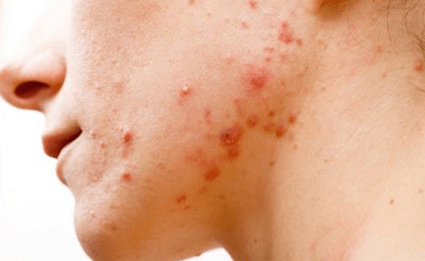 生活|肝毒难缠如何清除？每天坚持“2动一吃”，肝脏或会干净如初!