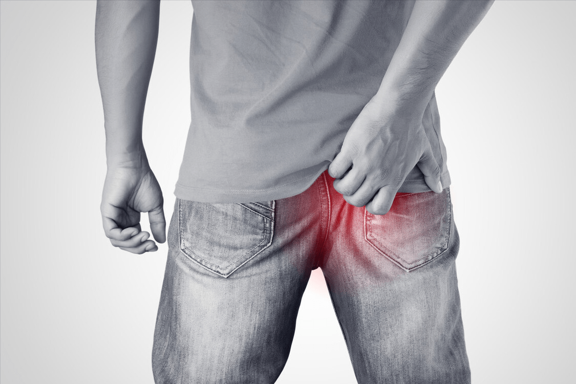 穴位|痔疮疼痛难耐？如果不知道怎么止疼，先按身体这两个位置再说