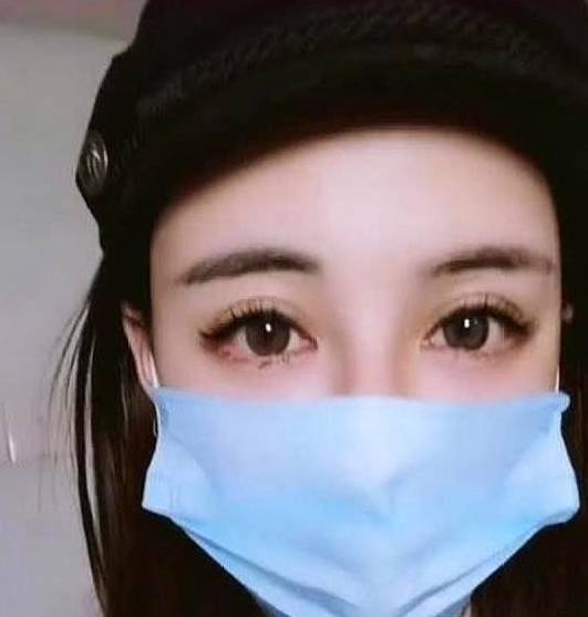 眼睛|女子整容成洋娃娃脸，闭上眼睛那一刻后悔了，网友：瞎折腾！