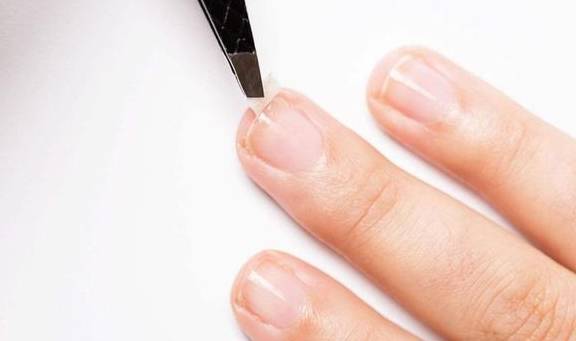 眼睛|体内有癌,眼睛先知,眼睛若出现一个特征,肝脏部位最好检查一下