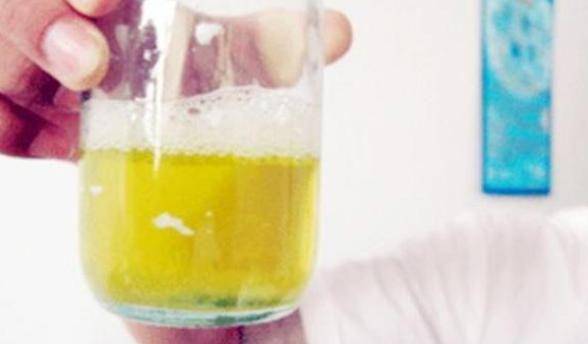 肝脏|肝脏问题隐匿又难缠！不过身体会用4种方式提醒你，早知道早预防