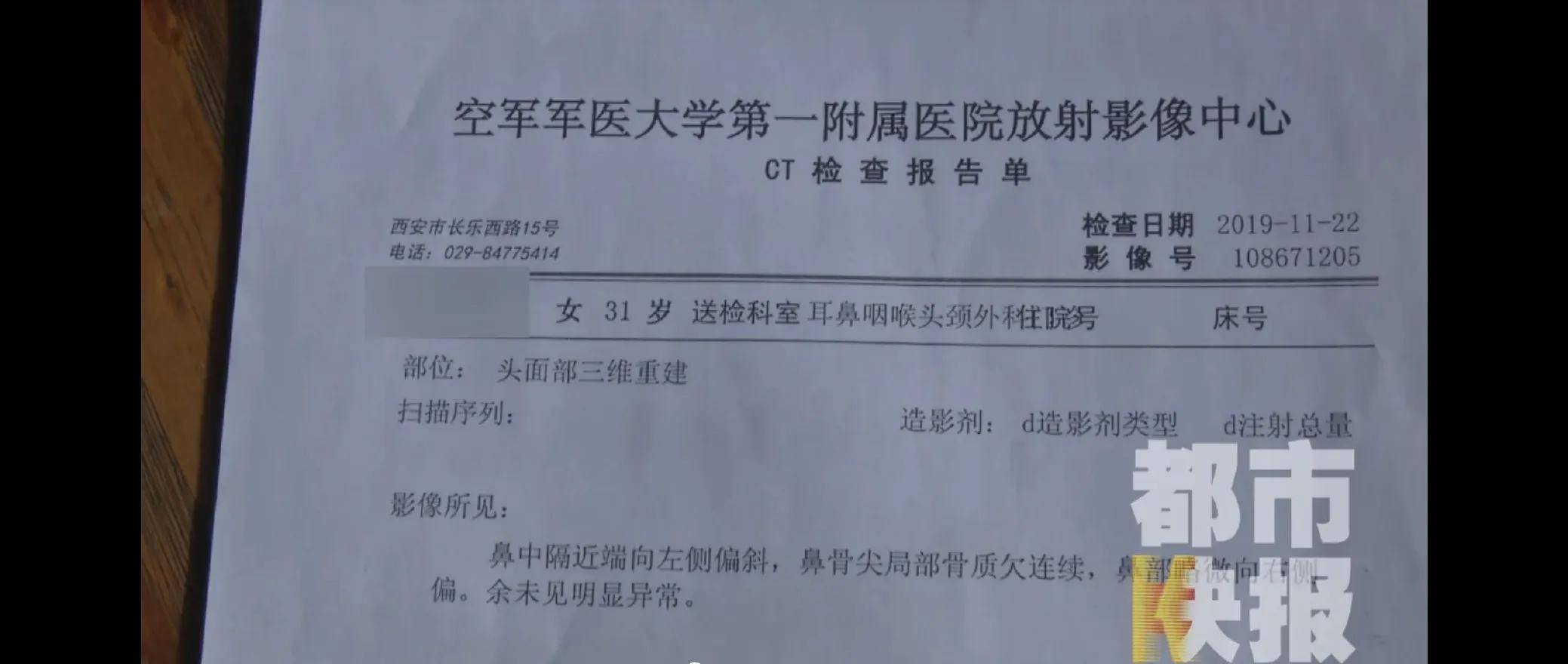 女子花9万在西安美莱医学整容医院做手术后鼻子歪了(图5)