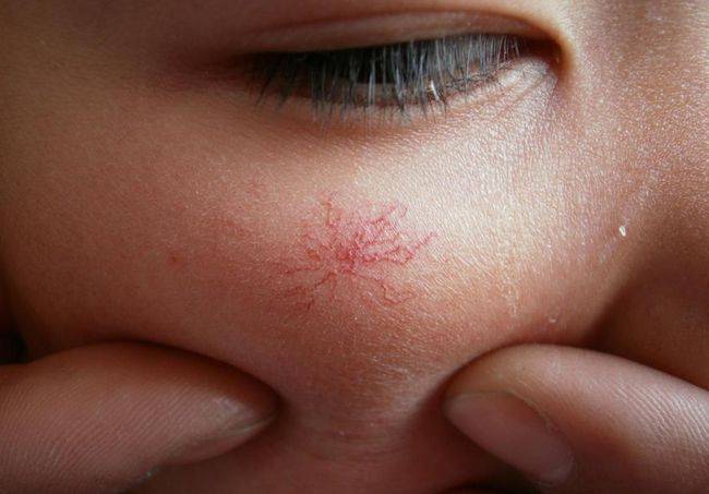 免疫力|身体出现这3种异常，或是感染HPV，避免宫颈病变要及时检查