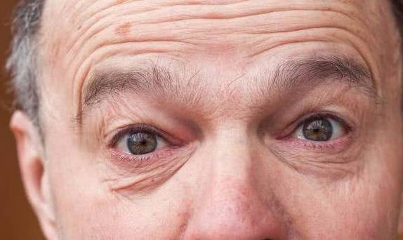 降低|血糖高，脸先知，多吃三菜，常饮三水，多按三穴，可平稳血糖！