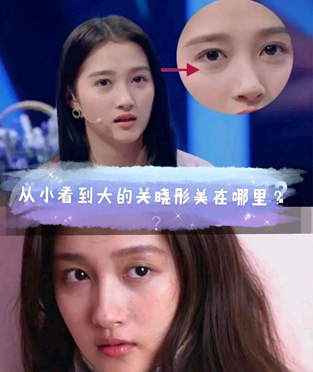 眼袋|年纪不大的关晓彤，为什么眼袋这么明显呢？