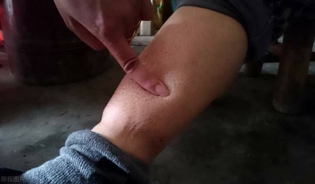 肾脏|男人每天排尿接近这个次数，恭喜你，尿毒症会离你很远