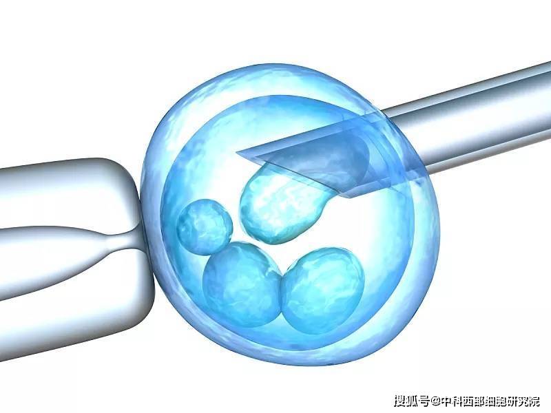 治疗|中科西部干细胞研究院：不同移植途径干细胞疗法治疗肝硬化研究案例