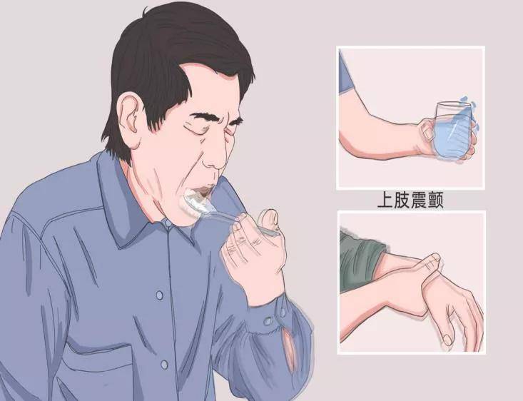 肝肾|特发性震颤和帕金森病有何不同？