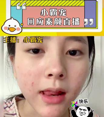 化妆品小霸宠首次透露素颜直播原因，审美跟大家不同，觉得满脸痘很好看