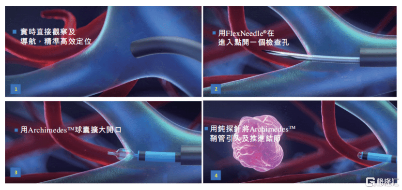 技术|堃博医疗-B（2216.HK）：全肺抵达的先进技术，介入呼吸病学第一股今日上市