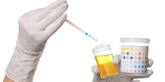 首选|查出尿蛋白1+怎么办？赶紧“3步走”，一步都不能少