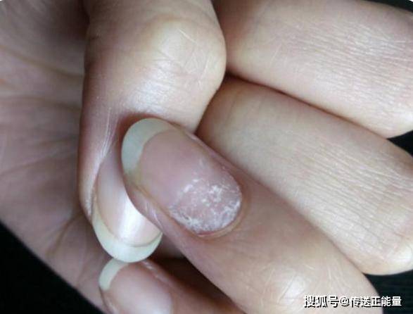 肝有癌中指知中指若存这4现象肝癌或已入侵身体