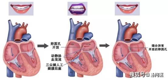 机械|他因嘴唇青紫，毫无红润血色，被送往医院