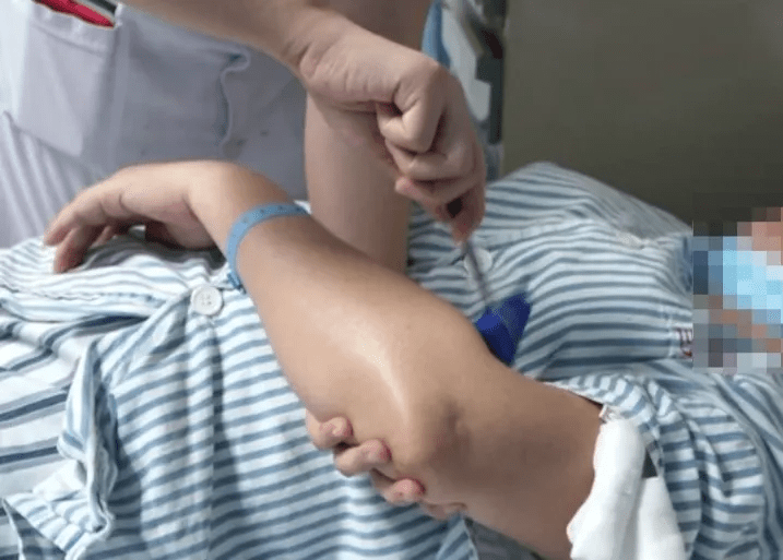 球菌|女子帮丈夫杀鸡后失去意识，险些丧命！医生：这病致死率高达40%