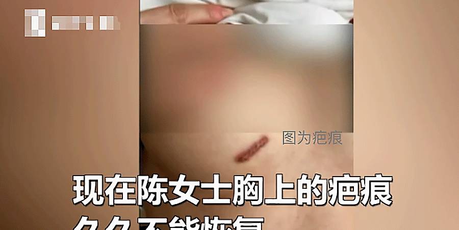 整形女子隆鼻，这里却留下疤痕！她怒了：我还没结婚没生孩子