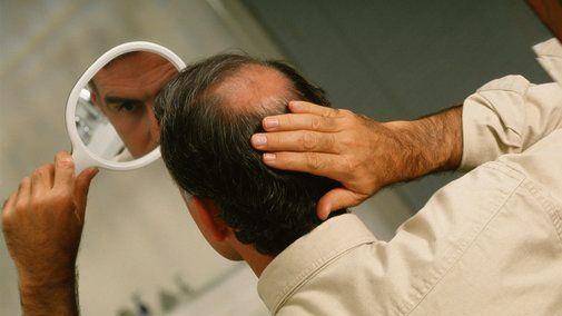 哪个特效可以看出头皮屑 5bf27e65dfb24106b3cc18fdeab8a5b1.jpeg