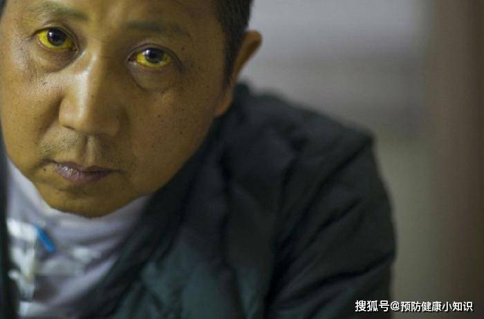 症状|53岁男子经常犯困，诊断为肝癌，医生：睡前1习惯惹得祸，趁早改掉