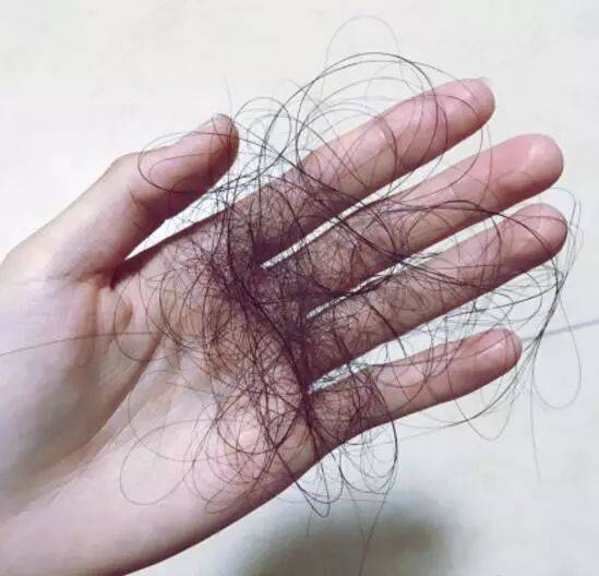 头皮|古芳栢草：掉发很厉害？可能你的洗头方式有问题！