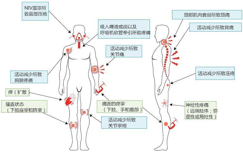 知识科普|肌萎缩性侧索硬化症这样治疗效果如何？