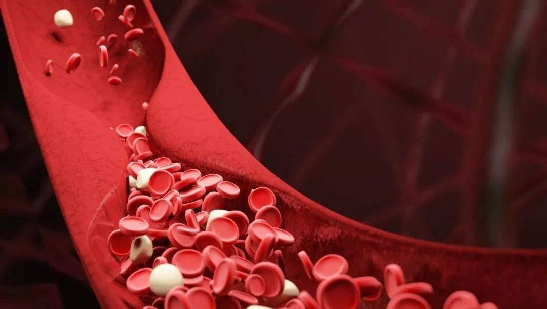 血管|主动脉弓钙化的患者，与遗传无关，常会有胸闷气短的症状