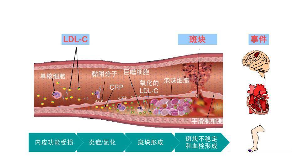 水平|血脂降到正常了，他汀类药物能不能隔天吃，会影响治疗效果吗？