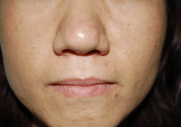 肝脏|肝脏好不好看晨起！若“五大表现”占两个，就要去检查下！