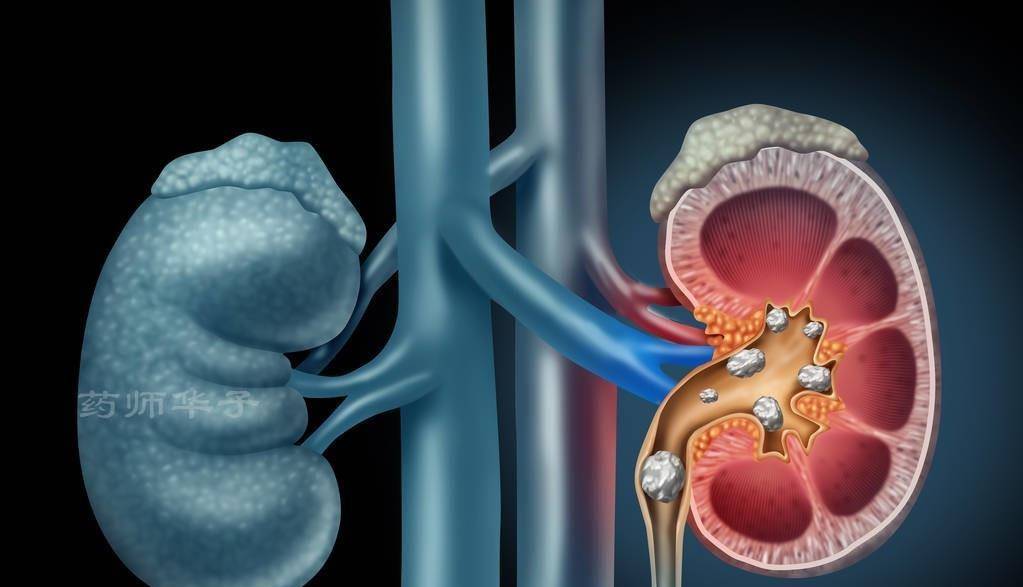 肾脏|多喝水是能排毒还是增加肾脏负担呢？多喝水与少喝水，哪个对？