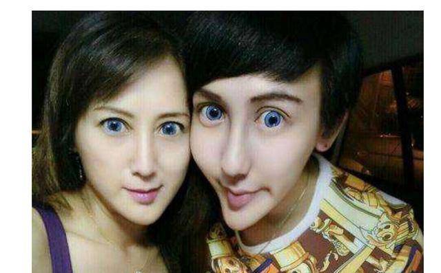 原创那个为成名整容成"蛇精脸"的小伙,因太帅被富婆追求,现状如何