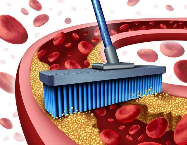 水平|阿托伐他汀与瑞舒伐他汀，降脂效果相似，在应用时有什么区别？