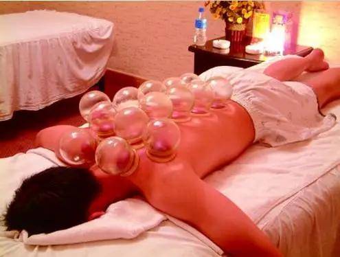 拔罐为啥不出痧 39c8153c078043fb97c41d7e884eeaeb.jpeg